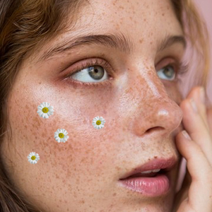 Невозможно игнорировать. Пигментные пятна: предотвратить, осветлить! Это невозможно игнорировать. Пятна: Профилактика и сокращение!