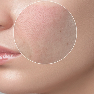 Порексия - серьезная проблема, которая сегодня волнует большинство женщин Полексия — серьезная проблема, от которой сегодня страдает большинство женщин