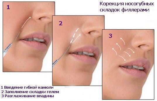 Как стереть тонкие линии?